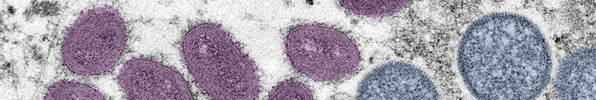 More Monkeypox in MS